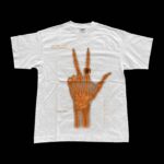 Bruson Xray