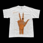 Bruson Xray