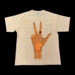 Bruson Xray - Image 2